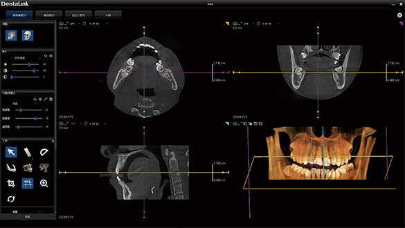 牙医管家口腔管理软件